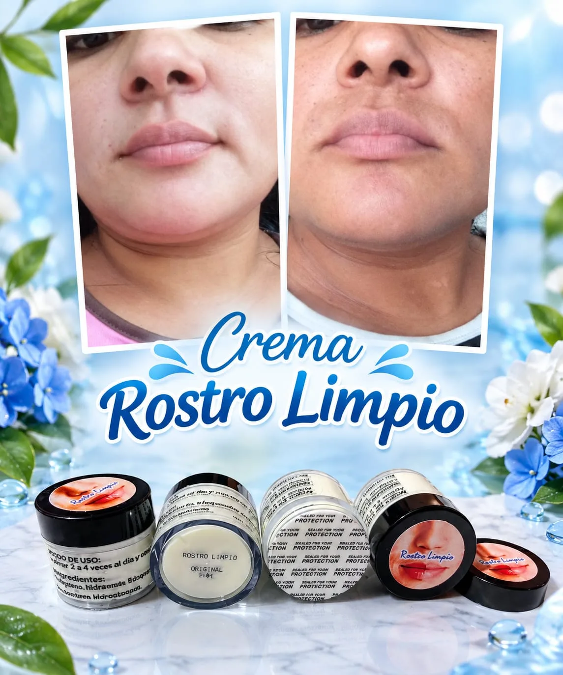 Rostro Limpio imagen 2